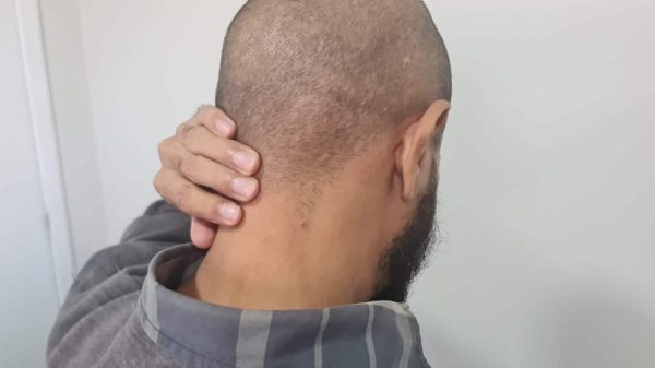 Alerta Meningite 2