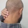 Alerta Meningite 2