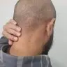 Alerta Meningite 2