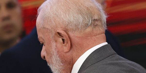 Lula tem dreno retirado da cabeca e esta lucido diz