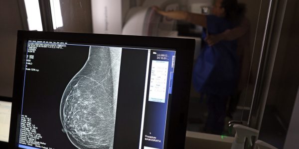 AGU processa medico que apontou mamografia como causadora de cancer
