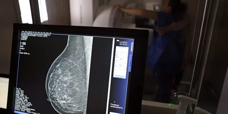 AGU processa medico que apontou mamografia como causadora de cancer