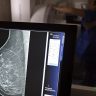 AGU processa medico que apontou mamografia como causadora de cancer
