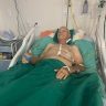 Cirurgia Cardiaca de Alta Complexidade Ascom Sesau 3