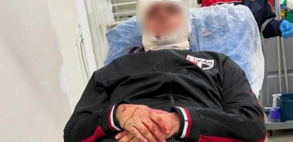 Torcedor do São Paulo machucado após queda de placa metálica no Morumbis