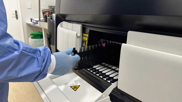 implantacao de nova tecnologia para ampliar a capacidade de exames sorologicos no lacen rr ascom ses