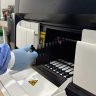 implantacao de nova tecnologia para ampliar a capacidade de exames sorologicos no lacen rr ascom ses