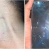 Celular da vítima quebrado após ataque em Rorainópolis